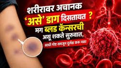 शरीरावर अचानक ‘असे’ डाग दिसतायत? मग ब्लड कॅन्सरची असू शकते सुरुवात, साधी गोष्ट समजून दुर्लक्ष करू नका; डॉक्टरांचा गंभीर इशारा