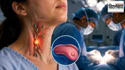 Tongue Cancer : जीभेच्या कर्करोगात मानेची मोठी शस्त्रक्रिया टाळता येणार? सेंटिनेल नोड बायोप्सी पद्धत नेमकी काय?