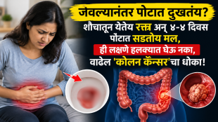 colon cancer symptoms