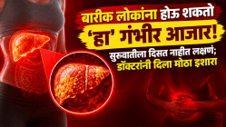 बारीक लोकांना होऊ शकतो ‘हा’ गंभीर आजार! सुरुवातीला दिसत नाहीत लक्षणं; डॉक्टरांनी दिला मोठा इशारा