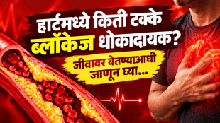 heart blockage percentage heart attack risk cardiologist advice