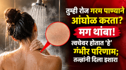 तुम्ही रोज गरम पाण्याने आंघोळ करता? मग थांबा! त्वचेवर होतात ‘हे’ गंभीर परिणाम; तज्ज्ञांनी दिला इशारा