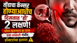 तोंडाचा कॅन्सर होण्याआधीच दिसतात ‘ही’ २ लक्षणे! छोटा वाटणारा हा त्रास ठरू शकतो गंभीर, डॉक्टरांचा इशारा