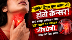 ‘इतके’ दिवस घसा बसला तर होतो कॅन्सर! साधं समजून दुर्लक्ष करू नका; ‘ही’ लक्षणं ठरू शकतात जीवघेणी, डॉक्टरांनी दिला इशारा