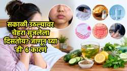 सकाळी उठल्यावर चेहरा सुजलेला दिसतोय? जाणून घ्या ‘ही’ ६ प्रमुख कारणं आणि घरगुती उपाय