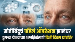 एका डोळ्याचं मोतीबिंदूचं ऑपरेशन झाल्यानंतर दुसऱ्या डोळ्याची शस्त्रक्रिया किती दिवसांनी करावी? ८ दिवस, १५ दिवस की एक महिना?