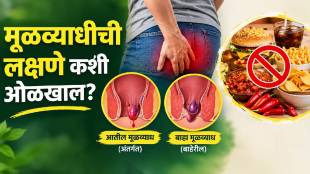 Foods to Avoid When Suffering From Piles
