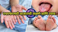 लहान मुलांच्या हाता-पायांवर अन् तोंडात पुरळ उठतेय? असू शकतो HFMD चा धोका; वाचा डॉक्टरांचा सल्ला