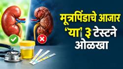 किडनी आतून चांगली की नाही लगेच कळेल! करून बघा ‘या’ ३ सोप्या टेस्ट; डॉक्टरांनी दिला सल्ला