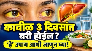 Jaundice symptoms and home care tips including healthy foods safe drinking water liver health and precautions for proper treatment