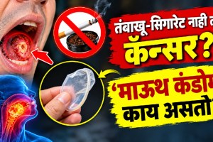 Dental dam or mouth condom explained for reducing HPV infection risk and protecting against sexually transmitted infections