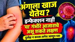अंगाला खाज येतेय? इन्फेक्शन नाही ‘या’ गंभीर आजाराचे असू शकते लक्षण, दुर्लक्ष न करता लगेच जाणून घ्या