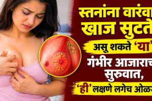 Breast Reast itching