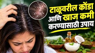 Remedies for Dandruff and Itchy Scalp