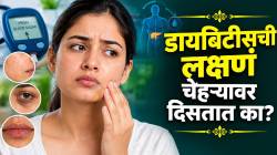 चेहऱ्यावरील ‘ही’ लक्षणं देतात डायबिटीसचे संकेत! चाचणीशिवाय ओळखणं खरंच शक्य आहे का? डॉक्टरांनी सांगितलं सत्य