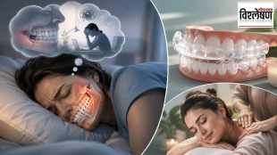 teeth grinding during sleep causes bruxism