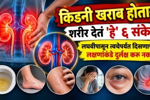 kidney disease early symptoms | early warning signs of kidney failure | renal health blood pressure swelling symptoms | kidney test serum creatinine egfr urine test