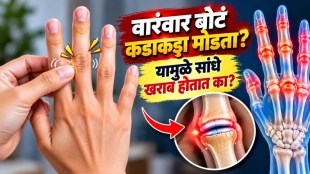cracking knuckles hand joints illustration | bone joint synovial fluid health | arthritis risk orthopedic advice | hand finger joint care tips