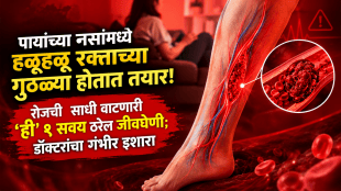 sitting for too long health risk blood clot risk vein thrombosis due to prolonged sitting doctor advice