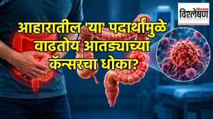 Ultraprocessed Foods Colon Cancer Risk | अतिप्रक्रिया केलेले पदार्थ आतड्याचा कॅन्सर