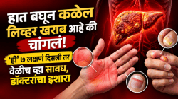 हात बघून कळेल लिव्हर खराब आहे की चांगलं! ‘ही’ ७ लक्षणं दिसली तर वेळीच व्हा सावध, डॉक्टरांचा इशारा
