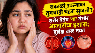 morning face swelling causes symptoms kidney thyroid health issues