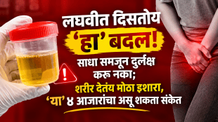 urine color change reason foamy urine causes health problems kidney uti diabetes blood pressure symptoms
