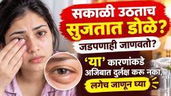 सकाळी उठताच सुजतात डोळे? जडपणाही जाणवतो? ‘या’ कारणांकडे अजिबात दुर्लक्ष करु नका, लगेच जाणून घ्या